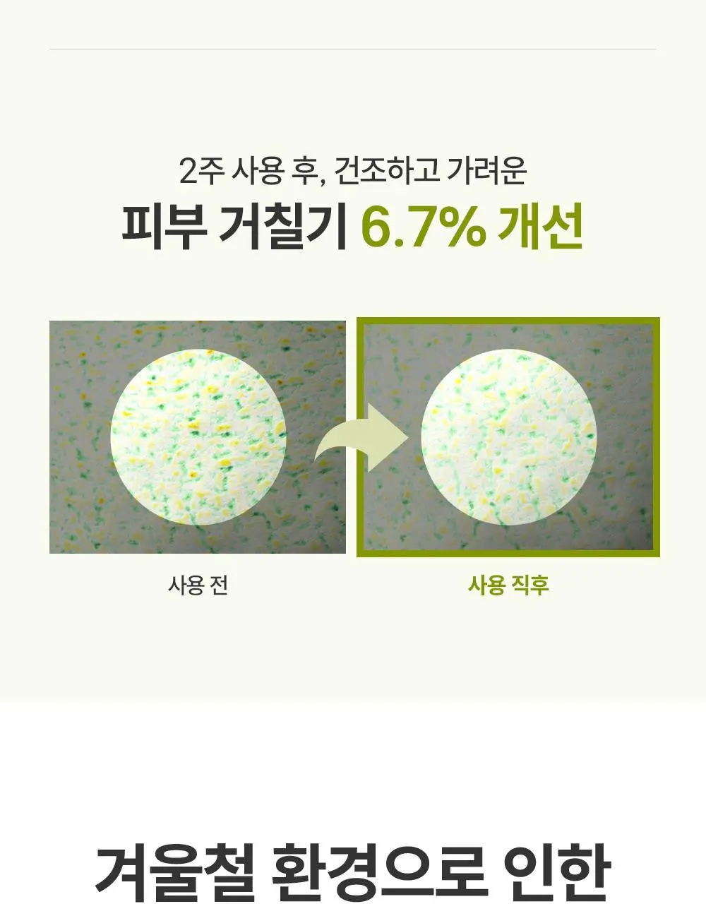 [2025 어워즈] 제로이드 인텐시브 크림 80ml 상세페이지 26